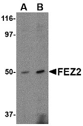 FEZ2 Antibody - Western blot of FEZ2 in mouse brain tissue lysate with FEZ2 antibody at (A) 0.5, and (B) 1 ug/ml.
