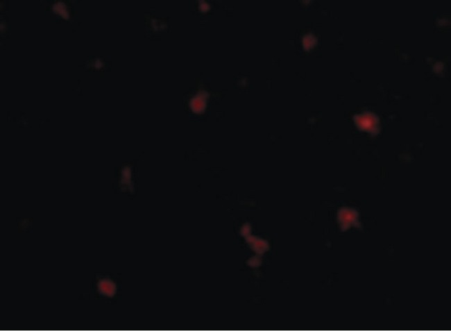 FEZ2 Antibody - Immunofluorescence of FEZ2 in Human Brain cells with FEZ2 antibody at 5 ug/ml.