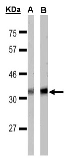FFAR1 / GPR40 Antibody - Sample(30 g of whole cell lysate). A: MOLT4. B: Raji. 15% SDS PAGE. FFAR1 antibody diluted at 1:1000.