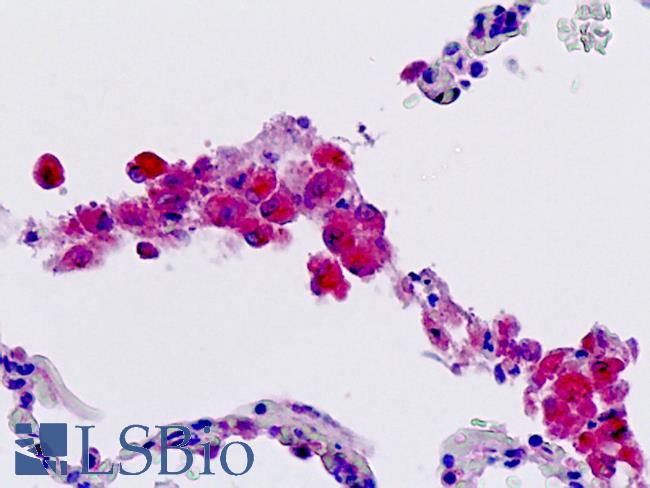 FFAR2 / GPR43 Antibody - Human, Lung, Macrophages: Formalin-Fixed Paraffin-Embedded (FFPE)