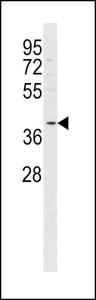 FFAR2 / GPR43 Antibody - FFAR2 Antibody western blot of MDA-MB453 cell line lysates (35 ug/lane). The FFAR2 antibody detected the FFAR2 protein (arrow).