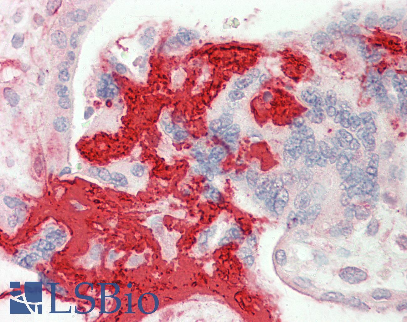 FGB / Fibrinogen Beta Chain Antibody - Anti-FGB antibody IHC staining of human placenta. Immunohistochemistry of formalin-fixed, paraffin-embedded tissue after heat-induced antigen retrieval.