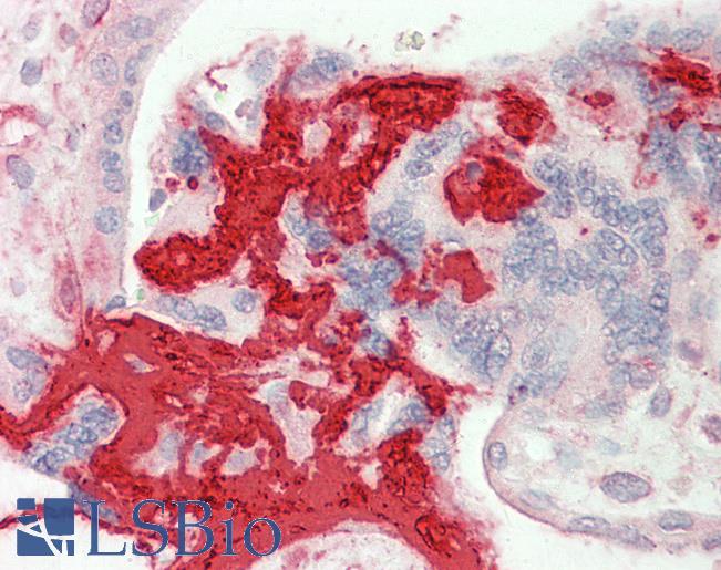 FGB / Fibrinogen Beta Chain Antibody - Anti-FGB antibody IHC staining of human placenta. Immunohistochemistry of formalin-fixed, paraffin-embedded tissue after heat-induced antigen retrieval.