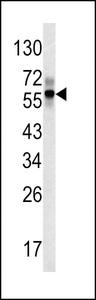 FGB / Fibrinogen Beta Chain Antibody - Western blot of FIBB antibody in mouse liver tissue lysates (35 ug/lane). FIBB (arrow) was detected using the purified antibody.