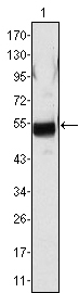 FGB / Fibrinogen Beta Chain Antibody - Western blot using FGB mouse monoclonal antibody against human plasma (1).