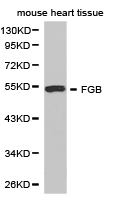 FGB / Fibrinogen Beta Chain Antibody - Western blot of extracts of mouse heart tissue cell lines, using FGB antibody.