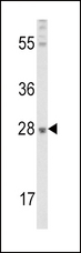 FGF10 Antibody - Western blot of FGF10 Antibody in mouse lung tissue lysates (35 ug/lane). FGF10 (arrow) was detected using the purified antibody.