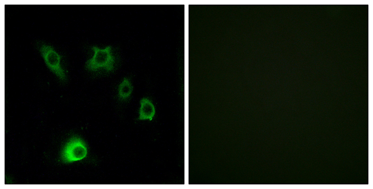 FGF18 Antibody - Immunofluorescence analysis of HUVEC cells, using FGF18 Antibody. The picture on the right is blocked with the synthesized peptide.