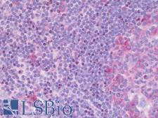 FGF18 Antibody - Anti-FGF18 antibody IHC staining of human tonsil. Immunohistochemistry of formalin-fixed, paraffin-embedded tissue after heat-induced antigen retrieval. Antibody dilution 1:50.