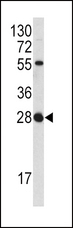 FGF18 Antibody - Western blot of FGF18 antibody in NCI-H460 cell line lysates (35 ug/lane). FGF18 (arrow) was detected using the purified antibody.