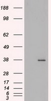 FGF2 / Basic FGF Antibody - HEK293T cells were transfected with the pCMV6-ENTRY control (Left lane) or pCMV6-ENTRY BFGF (Right lane) cDNA for 48 hrs and lysed. Equivalent amounts of cell lysates (5 ug per lane) were separated by SDS-PAGE and immunoblotted with anti-BFGF.
