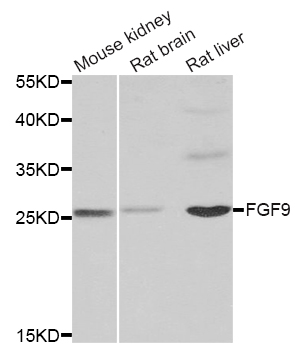 FGF9 Antibody - Western blot analysis of extracts of various tissues.