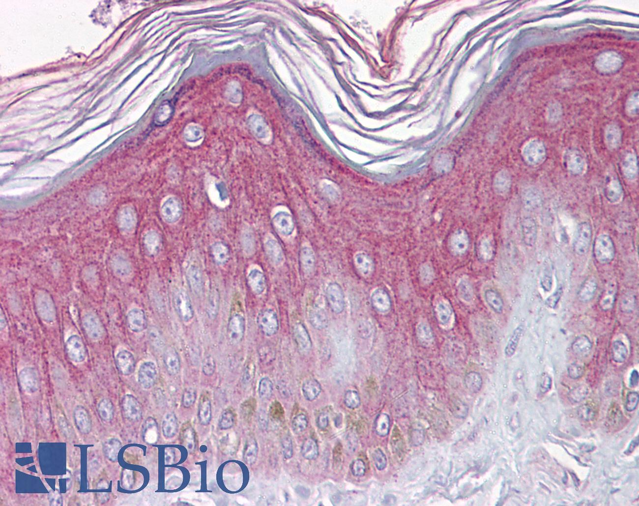 FGFR1 / FGF Receptor 1 Antibody - Anti-FGFR1 antibody IHC of human skin. Immunohistochemistry of formalin-fixed, paraffin-embedded tissue after heat-induced antigen retrieval. Antibody concentration 10 ug/ml.