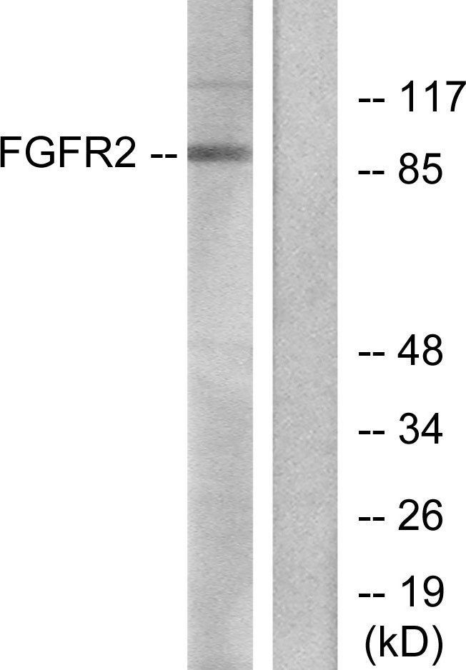 FGFR2 / FGF Receptor 2 Antibody - Western blot analysis of lysates from A549 cells, using FGFR2 Antibody. The lane on the right is blocked with the synthesized peptide.