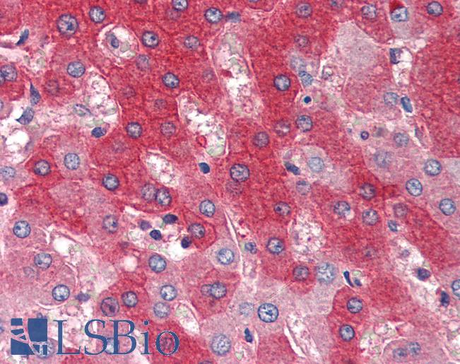 FGFR4 Antibody - Anti-FGFR4 antibody IHC of human liver. Immunohistochemistry of formalin-fixed, paraffin-embedded tissue after heat-induced antigen retrieval. Antibody dilution 1:200.