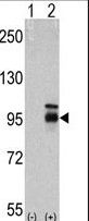 FGFR4 Antibody - Western blot of FGFR4 (arrow) using mouse monoclonal FGFR4 antibody. 293 cell lysates (2 ug/lane) either nontransfected (Lane 1) or transiently transfected with the FGFR4 gene (Lane 2) (Origene Technologies)