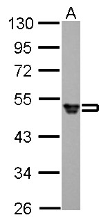 FGG / Fibrinogen Gamma Antibody - Fibrinogen gamma antibody detects FGG protein by Western blot analysis. A. 30 ug HepG2 whole cell lysate/extract. 10 % SDS-PAGE. Fibrinogen gamma antibody dilution:1:1000