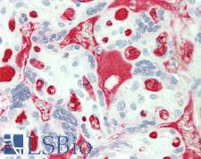 FGG / Fibrinogen Gamma Antibody - Human Placenta: Formalin-Fixed, Paraffin-Embedded (FFPE)
