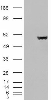 FH / Fumarase / MCL Antibody - FH / Fumarase / MCL antibody (0.01µg/ml) staining of Human Kidney lysate (35µg protein in RIPA buffer). Primary incubation was 1 hour. Detected by chemiluminescence.