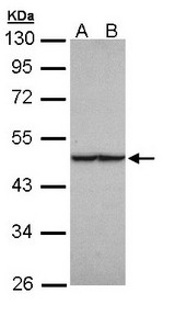 FH / Fumarase / MCL Antibody - Sample (30 ug of whole cell lysate). A: HeLa, B: Hep G2 . 10% SDS PAGE. FH / Fumarase antibody diluted at 1:1000
