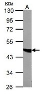 FH / Fumarase / MCL Antibody - Fumarate hydratase antibody detects FH protein by Western blot analysis. A. 50 ug mouse liver lysate/extract. 7.5% SDS-PAGE. Fumarate hydratase antibody dilution:1:1000.