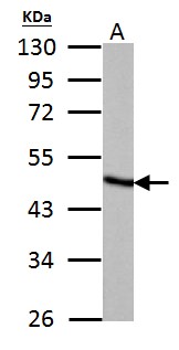 FH / Fumarase / MCL Antibody - Fumarate hydratase antibody detects Fumarate hydratase protein by Western blot analysis. A.50 ug rat liver lysate/extract. 10 % SDS-PAGE. Fumarate hydratase antibody dilution:1:5000