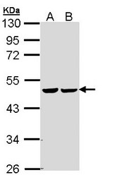 FH / Fumarase / MCL Antibody - Sample (30 ug of whole cell lysate). A:293T, B: A431 . 10% SDS PAGE. FH / Fumarase antibody diluted at 1:5000