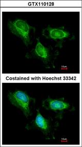 FH / Fumarase / MCL Antibody - Immunofluorescence of methanol-fixed HeLa using Fumarate hydratase antibody at 1:200 dilution.