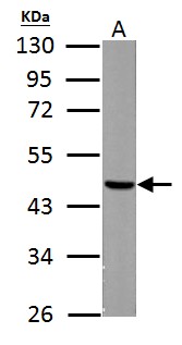 FH / Fumarase / MCL Antibody - Fumarate hydratase antibody [N2C2], Internal detects Fumarate hydratase protein by Western blot analysis. A.50 ug rat liver lysate/extract. 10 % SDS-PAGE. Fumarate hydratase antibody [N2C2], Internal dilution:1:5000