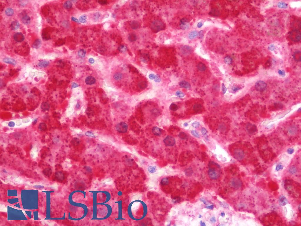 FH / Fumarase / MCL Antibody - Anti-FH / Fumarase / MCL antibody IHC staining of human liver. Immunohistochemistry of formalin-fixed, paraffin-embedded tissue after heat-induced antigen retrieval. Antibody concentration 7.5 ug/ml.