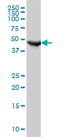 FH / Fumarase / MCL Antibody - FH monoclonal antibody (M09), clone 3E7 Western blot of FH expression in HeLa.