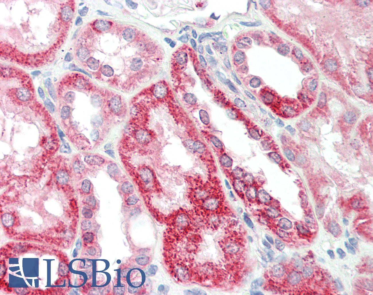 FH / Fumarase / MCL Antibody - Human Kidney: Formalin-Fixed, Paraffin-Embedded (FFPE)