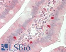 FHIT Antibody - Human Small Intestine: Formalin-Fixed, Paraffin-Embedded (FFPE)
