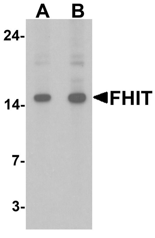 FHIT Antibody - Western blot analysis of FHIT in HeLa cell lysate with FHIT antibody at (A) 1 and (B) 2 ug/ml.