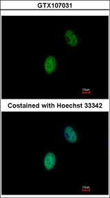 FHL5 Antibody - Immunofluorescence of paraformaldehyde-fixed HeLa using FHL5 antibody at 1:500 dilution.