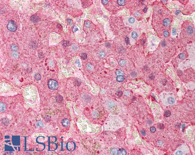 Fibrinogen Antibody - Anti-Fibrinogen antibody IHC of human liver. Immunohistochemistry of formalin-fixed, paraffin-embedded tissue after heat-induced antigen retrieval. Antibody dilution 1:500.