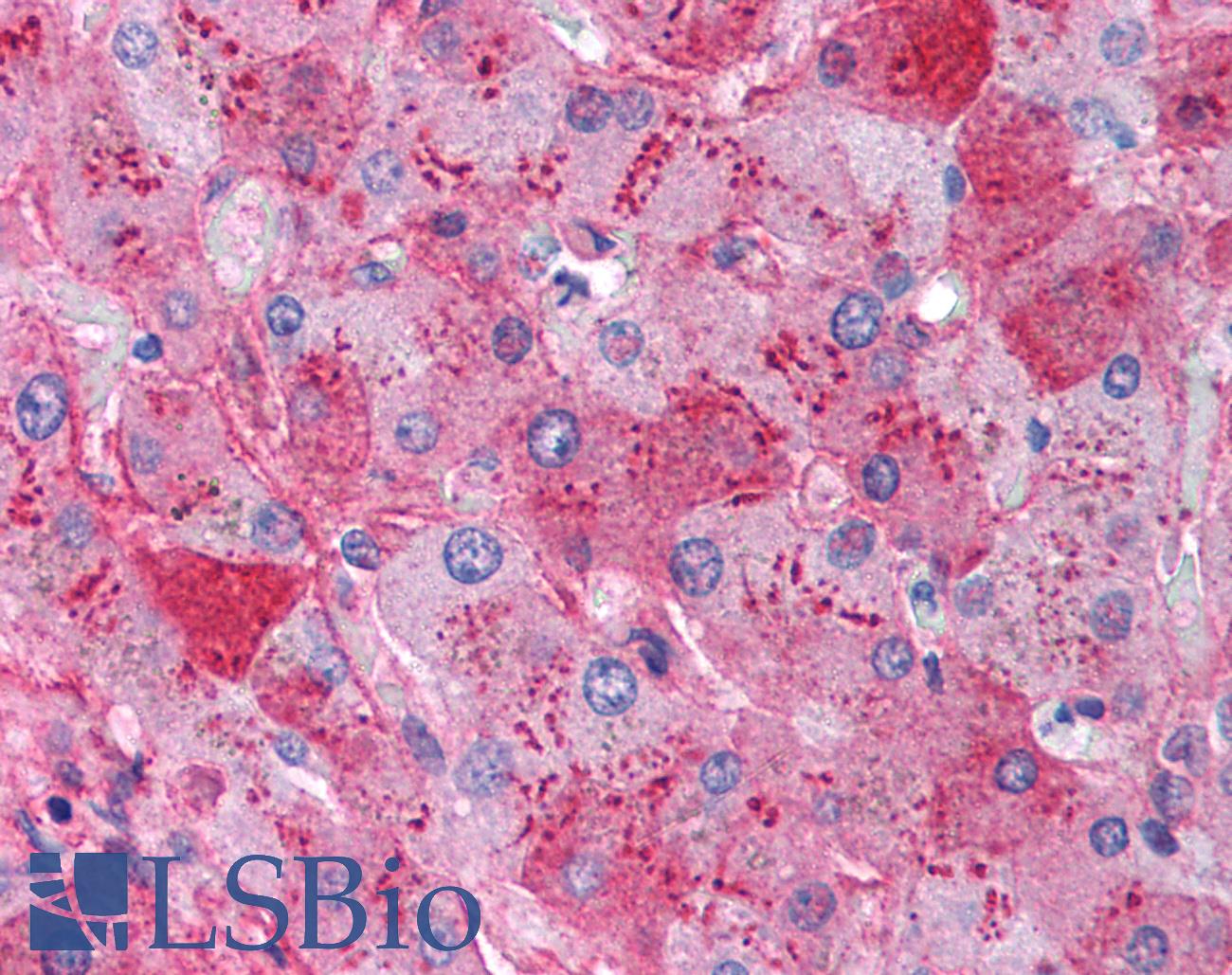 Fibrinogen Antibody - Anti-Fibrinogen antibody IHC of human liver. Immunohistochemistry of formalin-fixed, paraffin-embedded tissue after heat-induced antigen retrieval. Antibody concentration 5 ug/ml.
