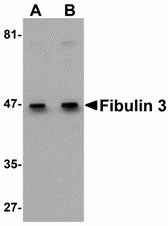 Fibulin-3 / EFEMP1 Antibody - Western blot of Fibulin 3 in HeLa cell lysate with Fibulin 3 antibody at (A) 0.5 and (B) 1 ug/ml.