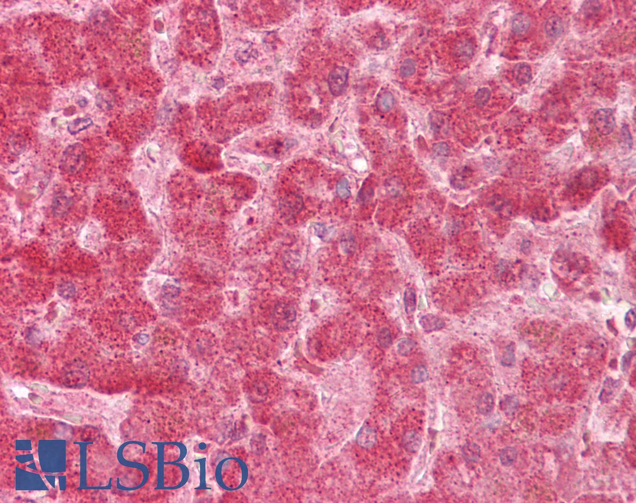FIS1 Antibody - Anti-FIS1 antibody IHC of human liver. Immunohistochemistry of formalin-fixed, paraffin-embedded tissue after heat-induced antigen retrieval. Antibody concentration 5 ug/ml.