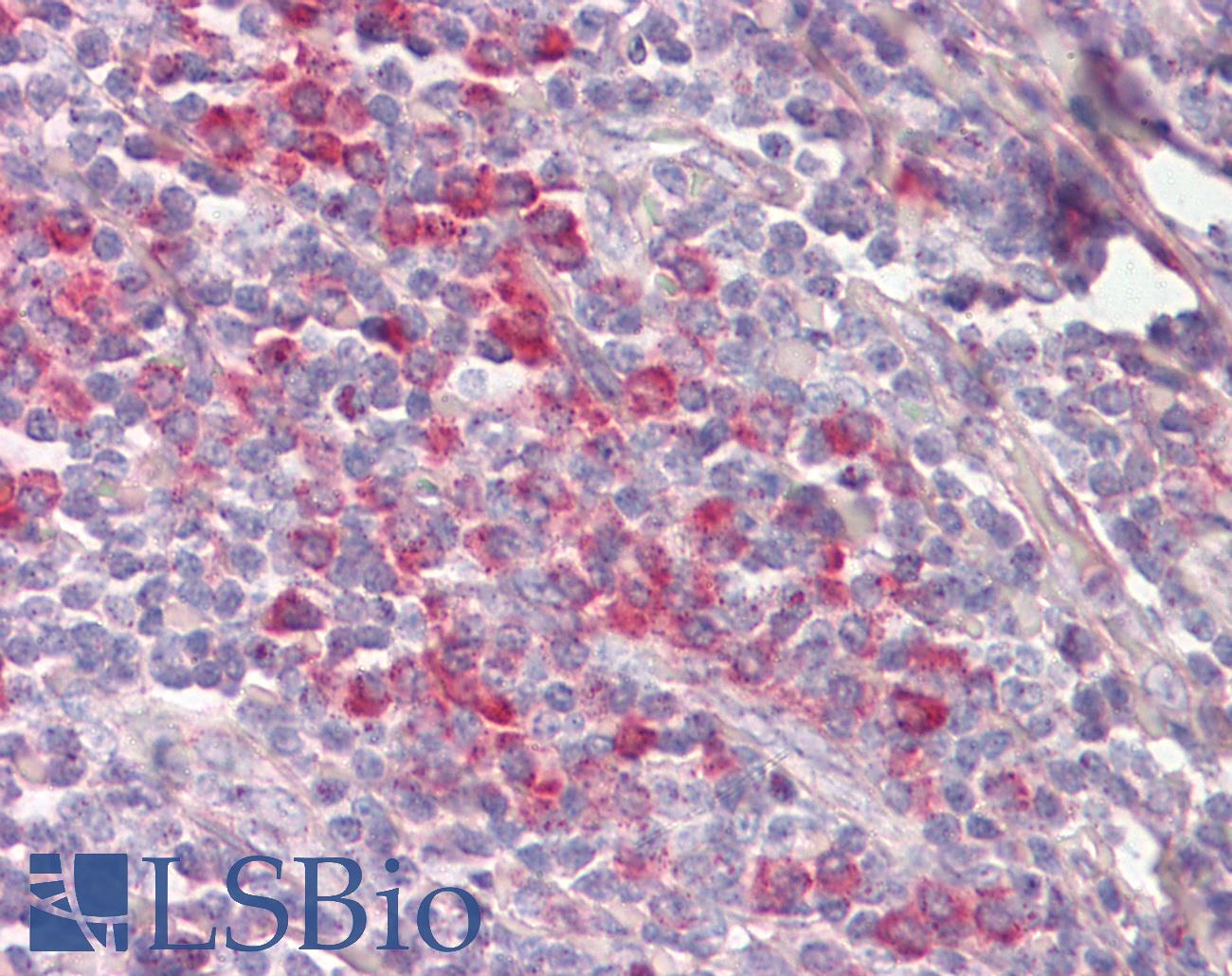 FIS1 Antibody - Anti-FIS1 antibody IHC staining of human tonsil. Immunohistochemistry of formalin-fixed, paraffin-embedded tissue after heat-induced antigen retrieval.