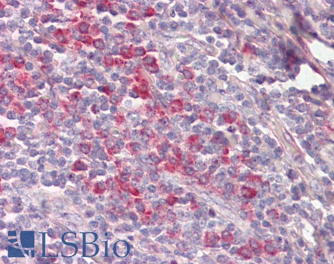 FIS1 Antibody - Anti-FIS1 antibody IHC staining of human tonsil. Immunohistochemistry of formalin-fixed, paraffin-embedded tissue after heat-induced antigen retrieval.