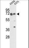 FKBP10 / FKBP65 Antibody - Western blot of FKBP10 Antibody in A2058 and A375 cell line lysates (35 ug/lane). FKBP10 (arrow) was detected using the purified antibody.