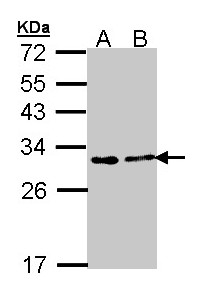 FKBP25 / FKBP3 Antibody - Sample (30 ug of whole cell lysate). A: A431. B: H1299. 12% SDS PAGE. FKBP3 antibody diluted at 1:1000. 