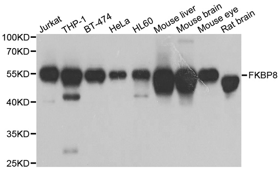 FKBP38 / FKBP8 Antibody - Western blot analysis of extracts of various cell lines.