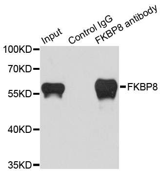 FKBP38 / FKBP8 Antibody - Immunoprecipitation analysis of 200ug extracts of HeLa cells.