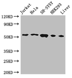 FKBP38 / FKBP8 Antibody - Positive WB detected in:Jurkat whole cell lysate,Hela whole cell lysate,SH-SY5Y whole cell lysate,HEK293 whole cell lysate,Mouse liver tissue;All lanes:FKBP8 antibody at 3ug/ml;Secondary;Goat polyclonal to rabbit IgG at 1/50000 dilution;Predicted band size: 45,28 kDa;Observed band size: 55 kDa;
