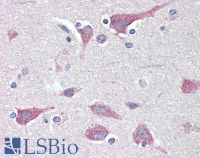 FKBP38 / FKBP8 Antibody - Human Brain, Cortex: Formalin-Fixed, Paraffin-Embedded (FFPE), at a concentration of 10 ug/ml. 