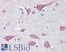 FKBP38 / FKBP8 Antibody - Human Brain, Cortex: Formalin-Fixed, Paraffin-Embedded (FFPE), at a concentration of 10 ug/ml. 