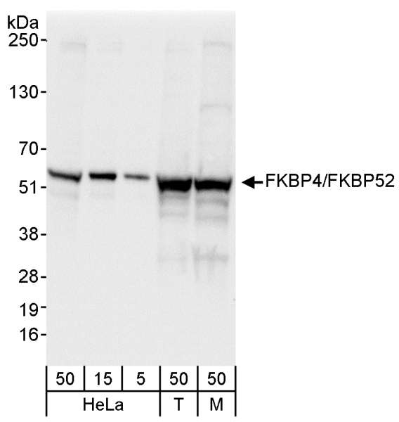 FKBP4 / FKBP52 Antibody - Detection of Human and Mouse FKBP4/FKBP52 by Western Blot. Samples: Whole cell lysate from HeLa (5, 15 and 50 ug), 293T (T; 50 ug), and mouse NIH3T3 (M; 50 ug) cells. Antibody: Affinity purified rabbit anti-FKBP4/FKBP52 antibody used for WB at 0.04 ug/ml. Detection: Chemiluminescence with an exposure time of 1 second.