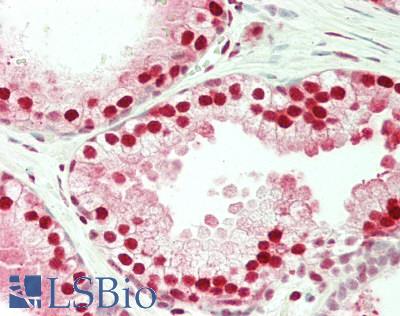 FKBP5 / FKBP51 Antibody - Human Prostate: Formalin-Fixed, Paraffin-Embedded (FFPE)